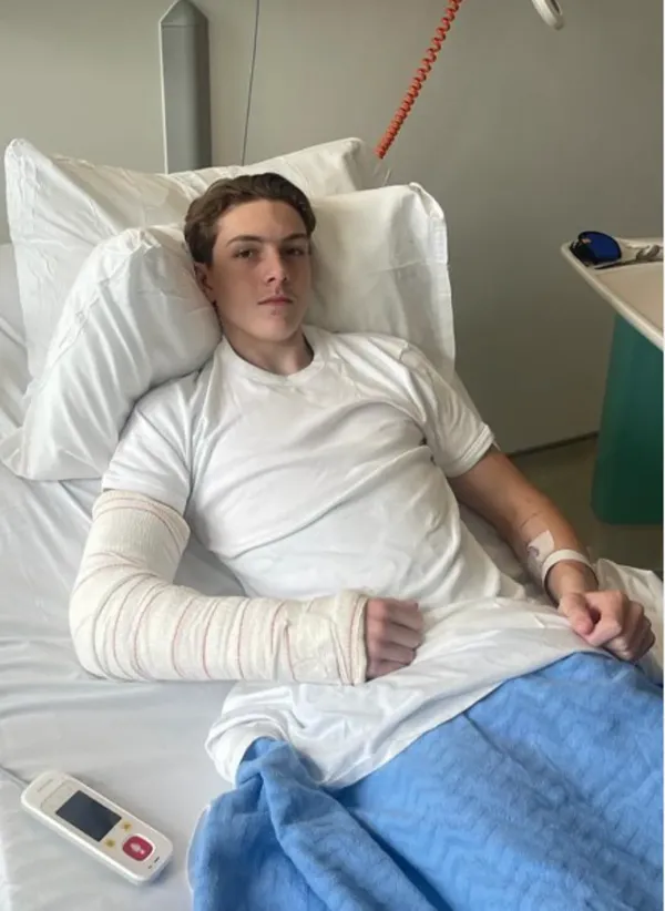 Fitzgerald suffered four broken vertebrae in his lower back and a broken elbow (Instagram - adamfitzgerald__)